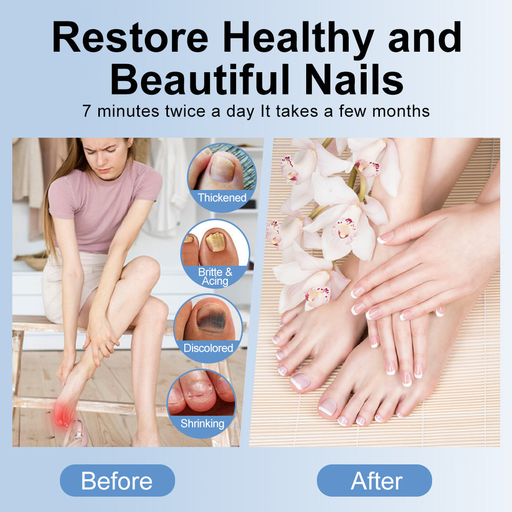 Before and after comparison of nail health with a woman sitting on a chair and hands with healthy nails.